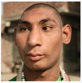 کودکان موشی شاه دولا